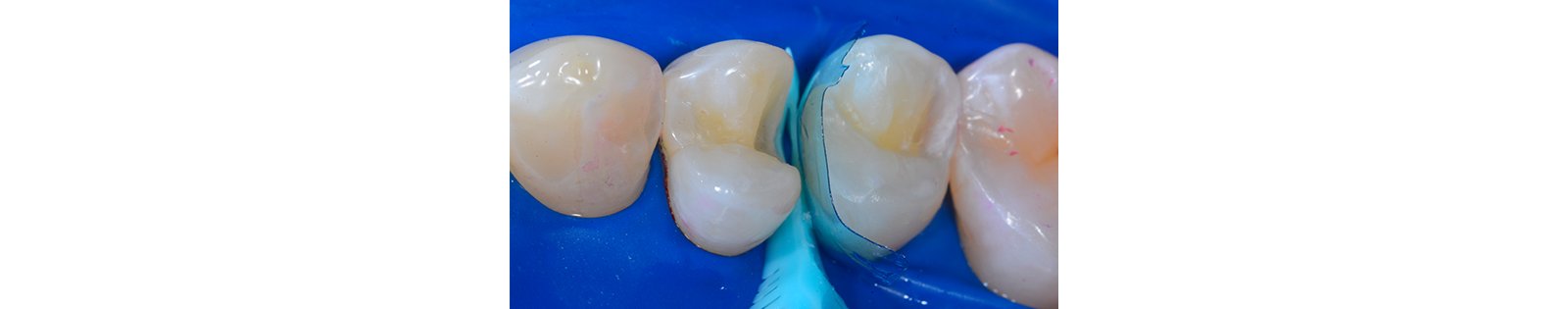 Informative oral care related imagery with a file name of 09-1.jpg shown on Solventum's "Brain Floss" blog