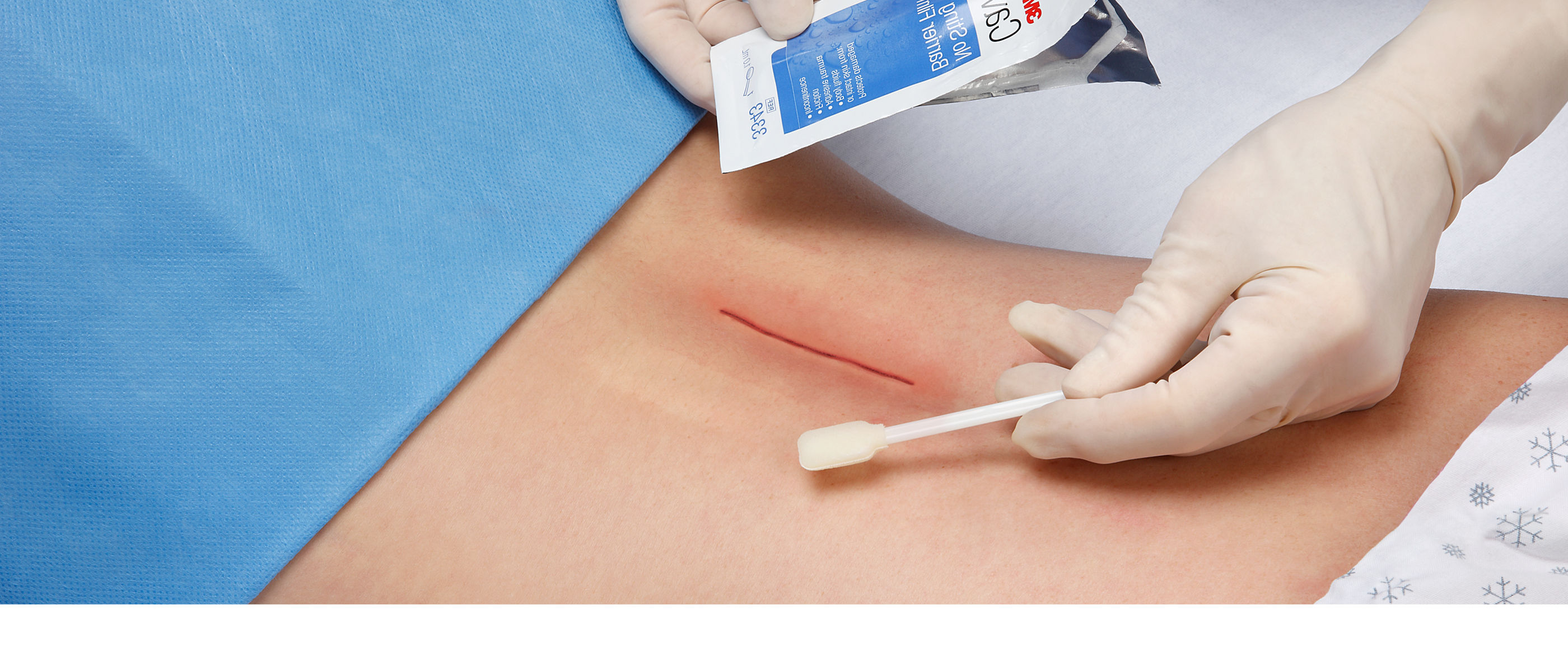 Cavilon No Sting Barrier Film 3343, Swab, Back, Spine, Epidural, application image, rgb, tiff, 70-2010-9186-8