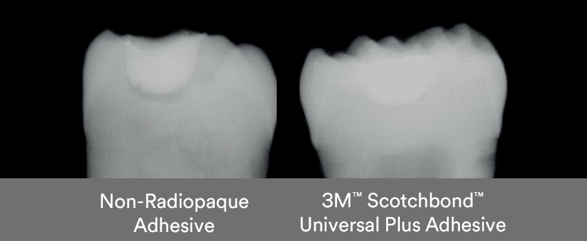 Informative oral care related imagery with a file name of Article_Begin-with-the-end-in-mind-the-secret-to-veneer-prep_1.png shown on Solventum's "Brain Floss" blog