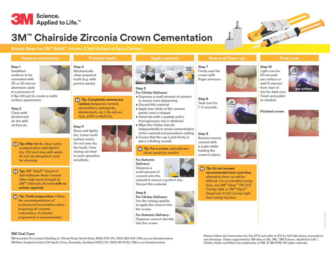 3M Chairside Zirconia Cementation Guide
