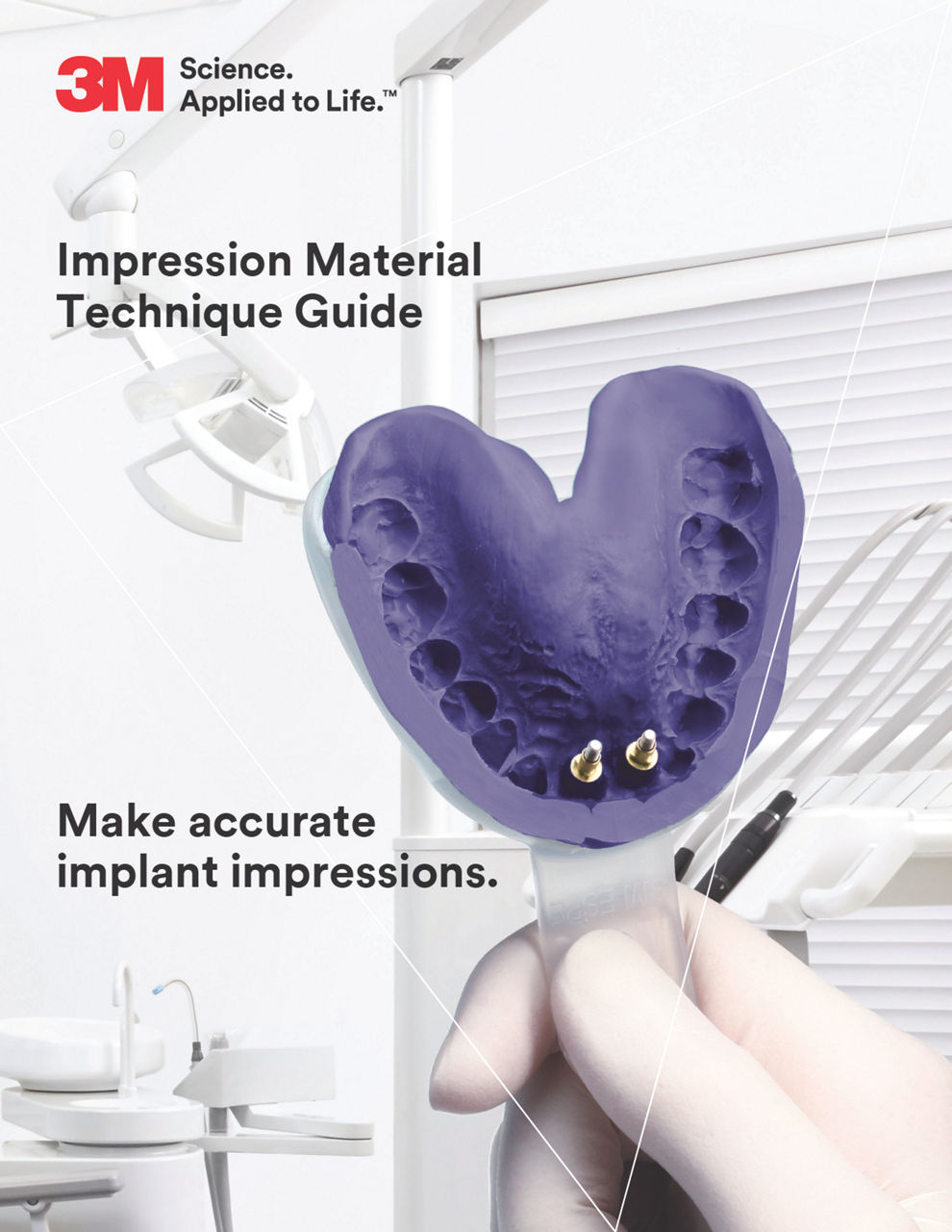 3M Impression Materials Implant Technique Guide