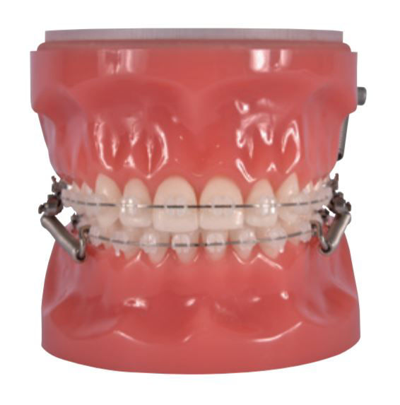 3M™ SmartClip™ Appliance System Typodont, 600-221, 1/Ea