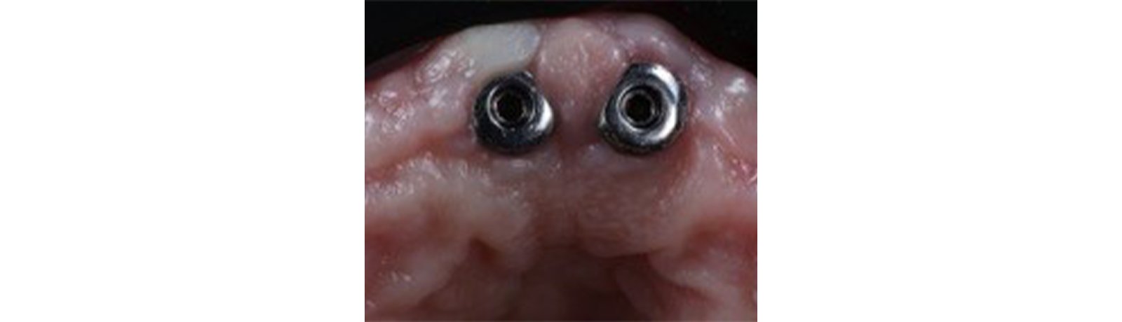 Informative oral care related imagery with a file name of 17030-Feature-image-560x400-1.png shown on Solventum's "Brain Floss" blog