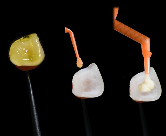 3M™ Ketac™ Universal Aplicap™ Glass Ionomer Restorative