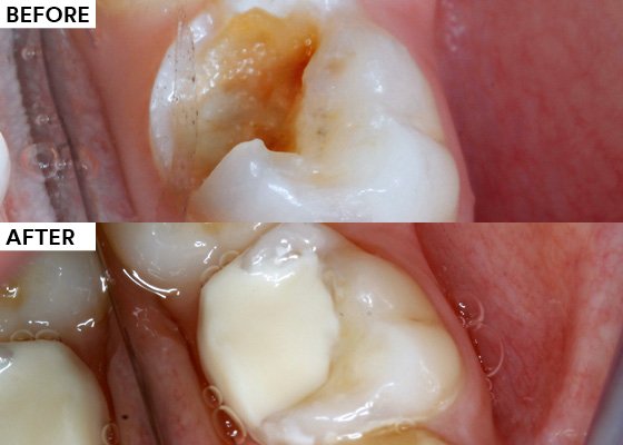 Informative oral care related imagery with a file name of 17076-Single-visit-efficiency-graphic-850x255-1.png shown on Solventum's "Brain Floss" blog