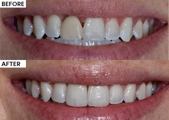 Informative oral care related imagery with a file name of 17-1.jpg shown on Solventum's "Brain Floss" blog