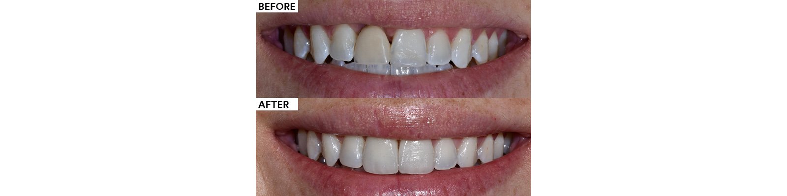 Informative oral care related imagery with a file name of 17-1.jpg shown on Solventum's "Brain Floss" blog