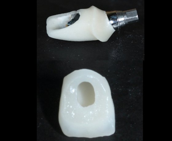 Application of adhesive