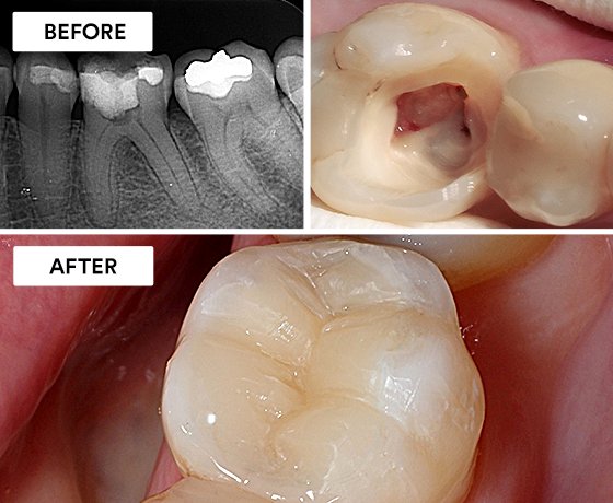 Informative oral care related imagery with a file name of real-homerun-560x400-1.jpg shown on Solventum's "Brain Floss" blog