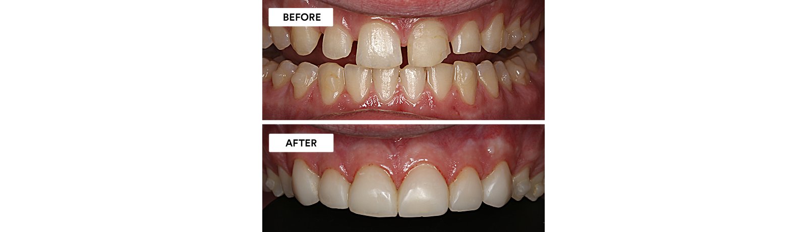 Informative oral care related imagery with a file name of 19-1.jpg shown on Solventum's "Brain Floss" blog
