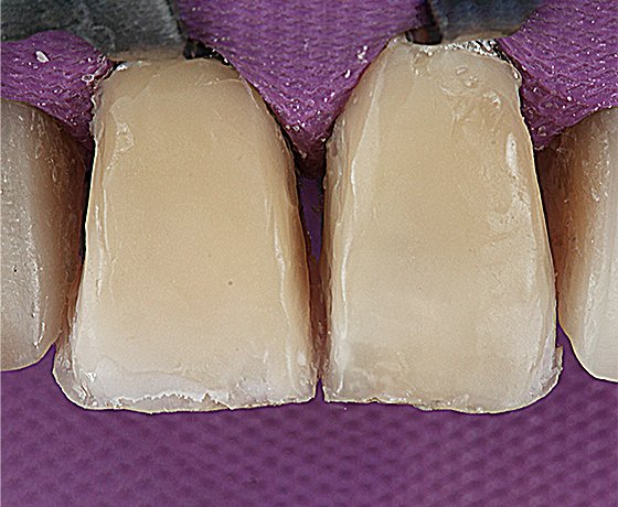 Results