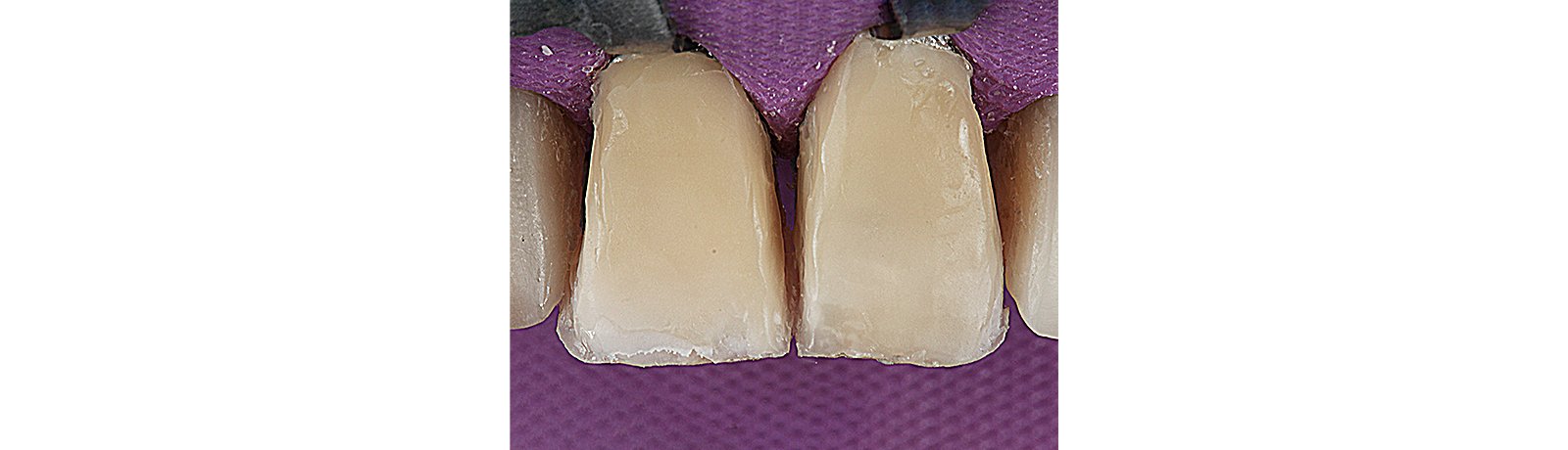 Results