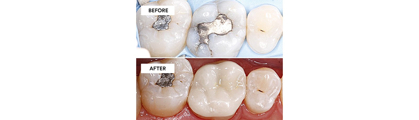 Informative oral care related imagery with a file name of Giuseppe_Chiodera_Fig_17_rz.jpg shown on Solventum's "Brain Floss" blog