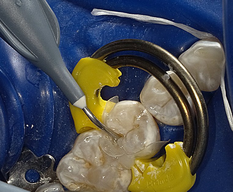 Flowable Restorative