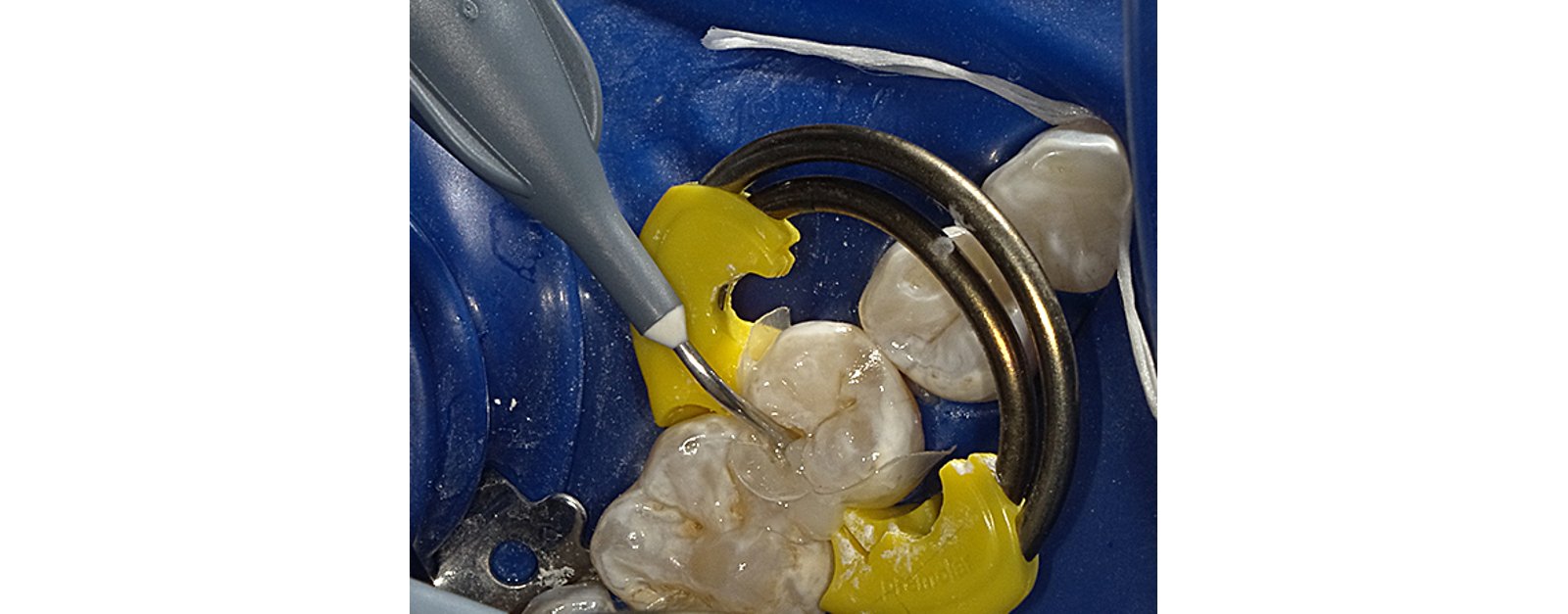 Flowable Restorative
