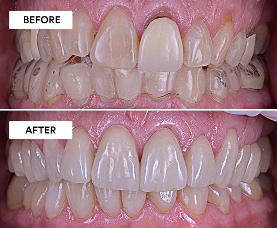 Informative oral care related imagery with a file name of Giuseppe-Chiodera-Fig.-10_rz-1.jpg shown on Solventum's "Brain Floss" blog