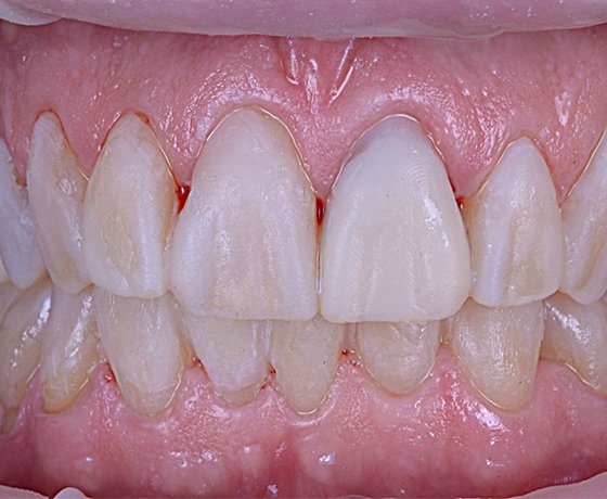 close up of teeth