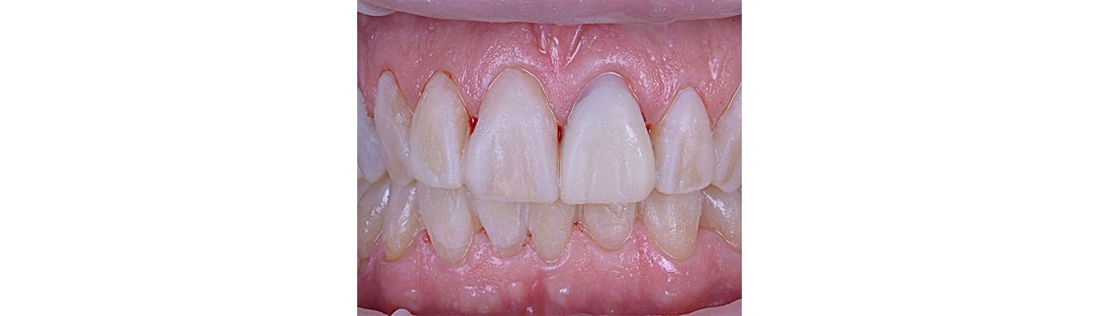 close up of teeth