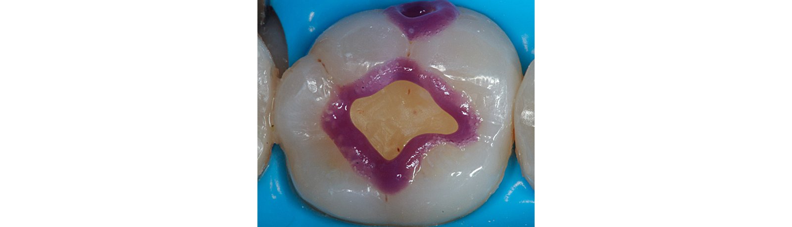 close up of teeth