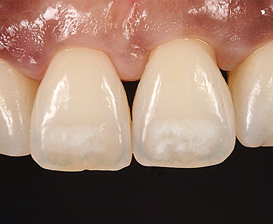 close up of teeth
