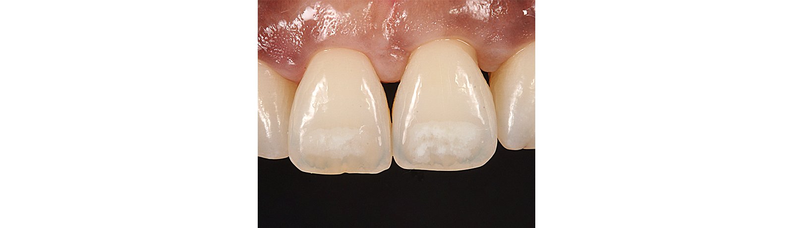 close up of teeth