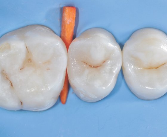 composite