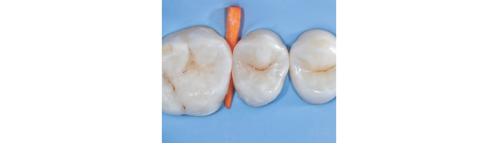 composite