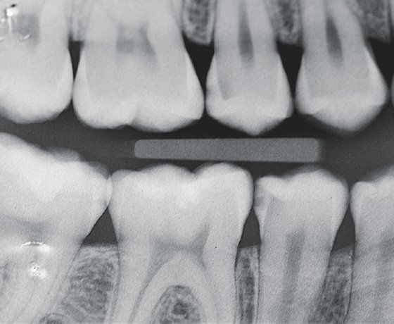 Radiograph