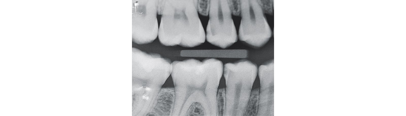 Radiograph