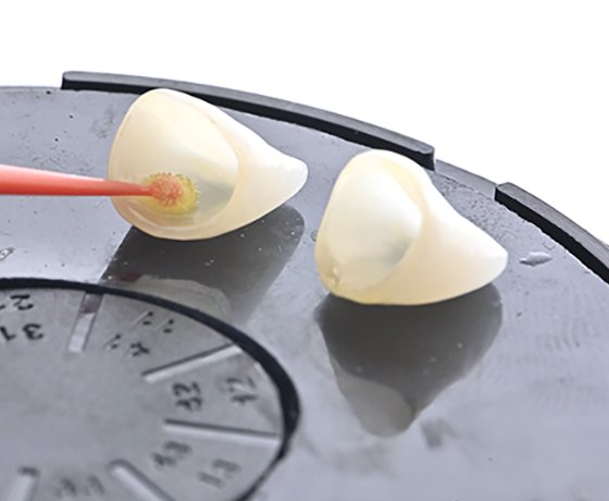 Application of 3M™ Scotchbond™ Universal Plus Adhesive