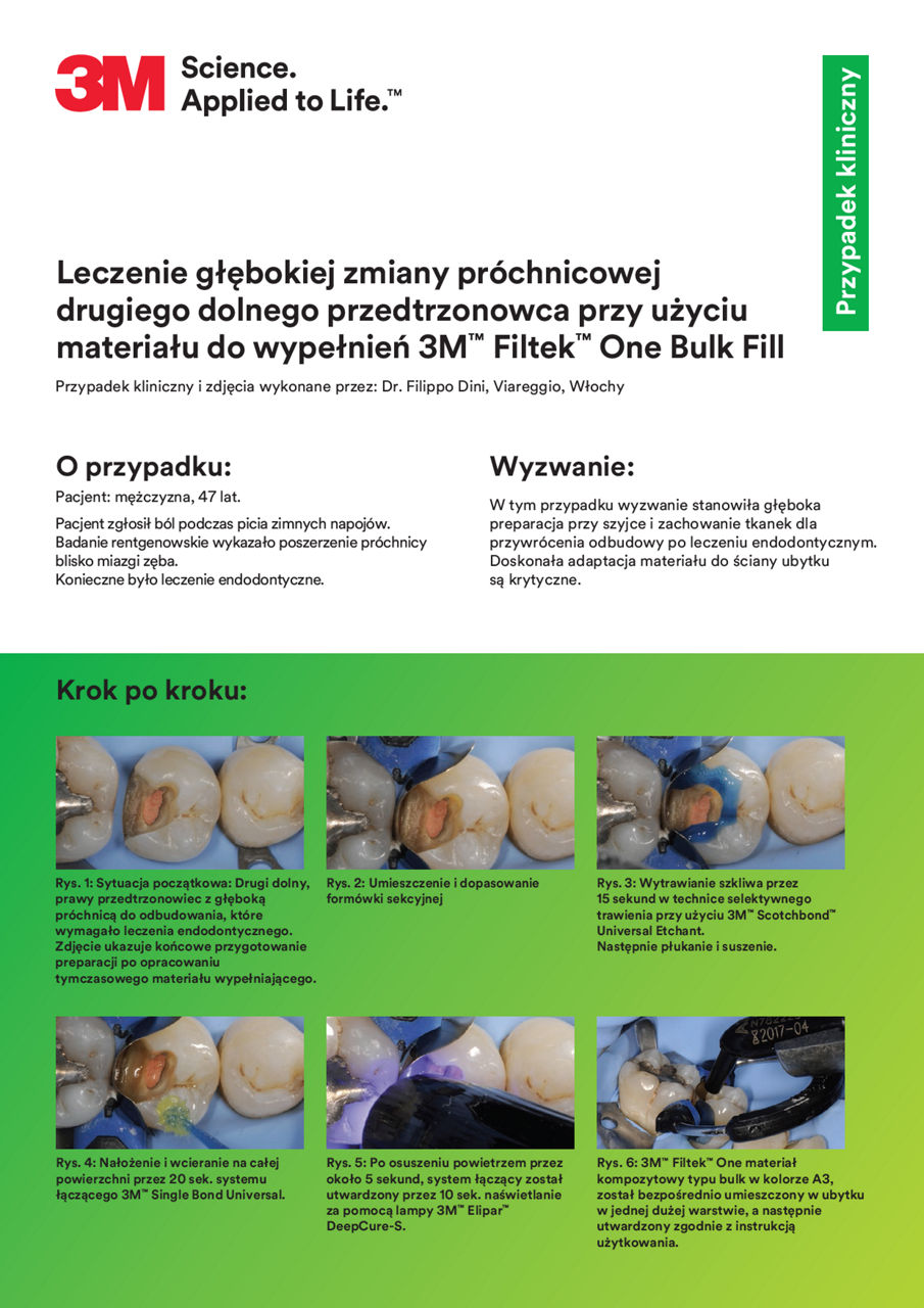 3M Filtek One Bulk Fill Dr Dini Clinical Case, A4,_PL (2019.04)