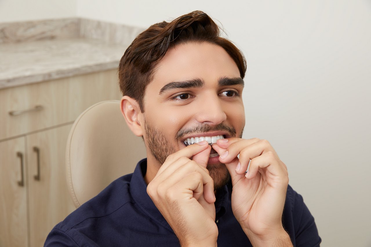 Adult male patient inserts 3M™ Clarity™ Aligners while wearing  3M™ Clarity™ Advanced Ceramic Brackets with hand mirror.