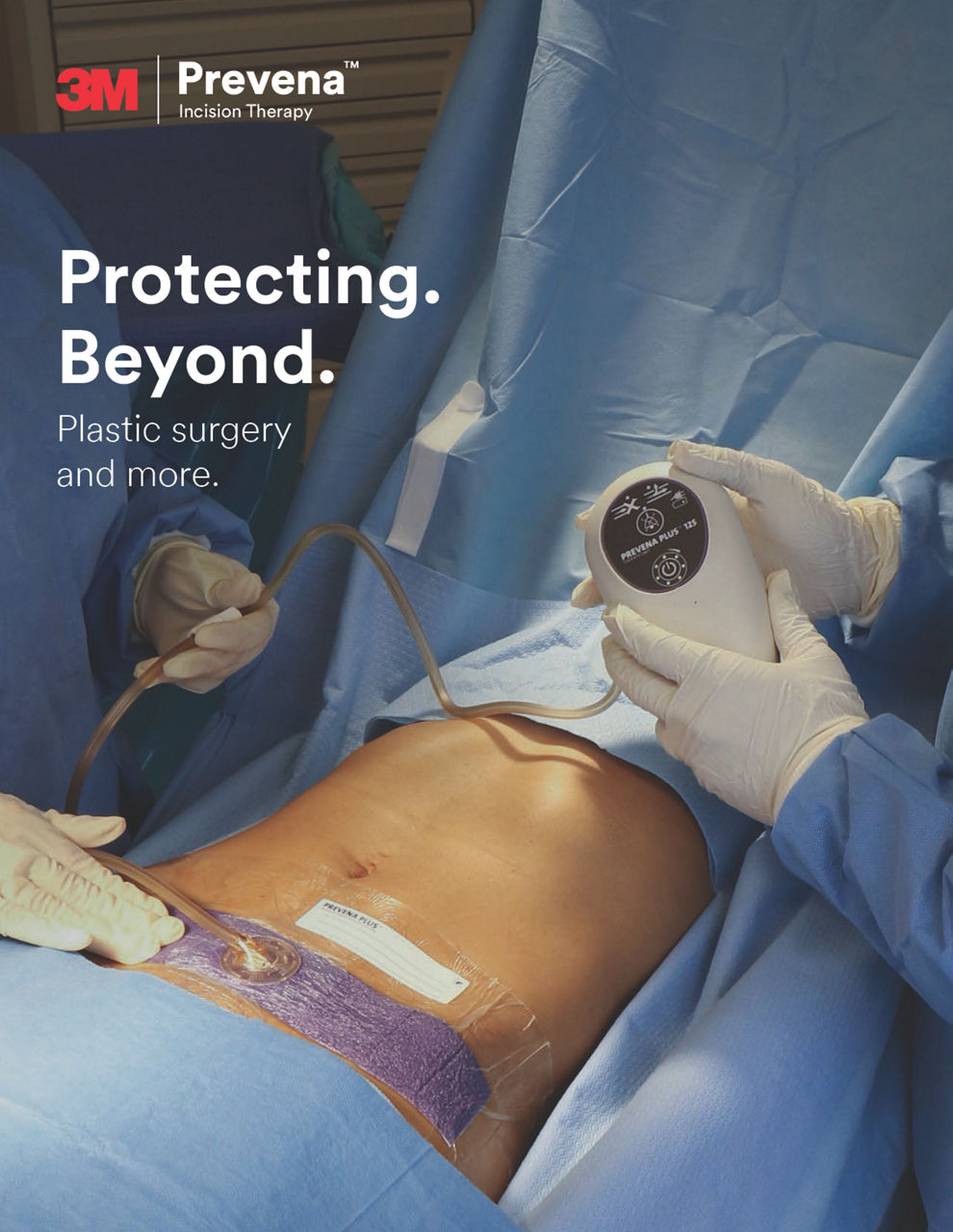 Prevena therapy after plastic surgery clinical evidence cover preview