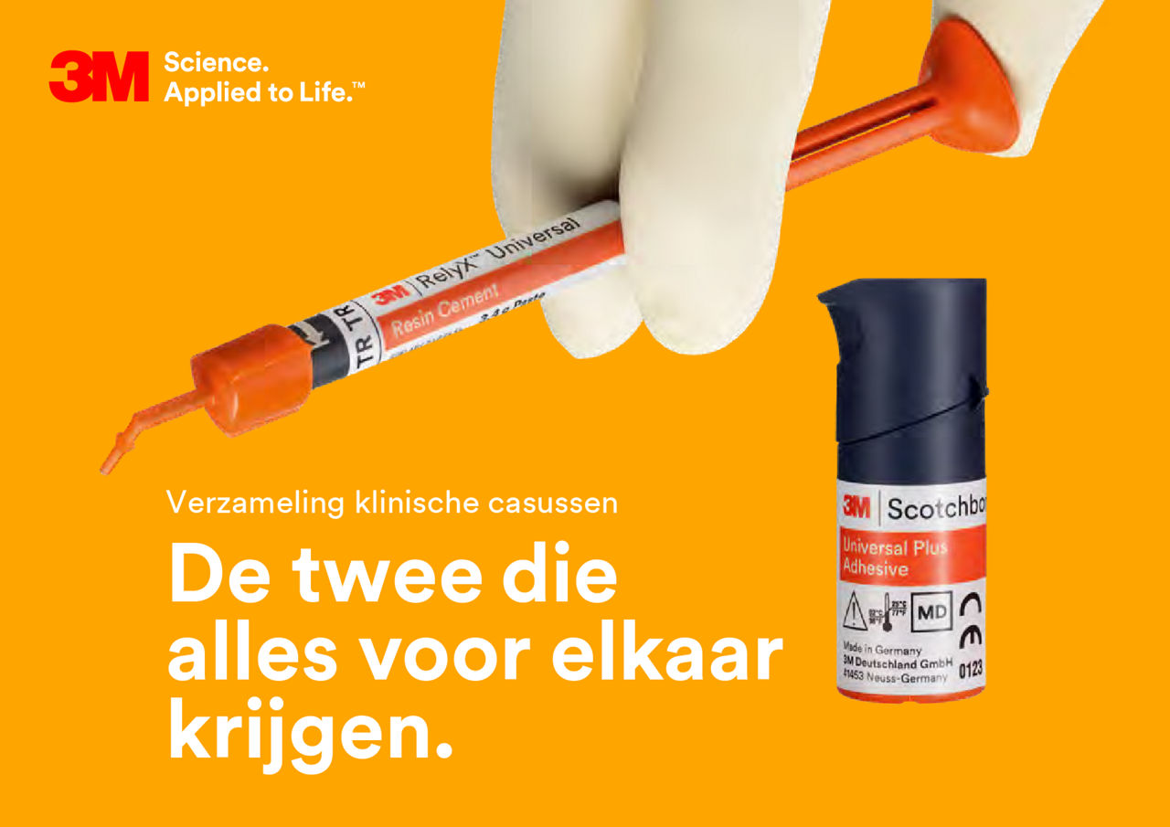 3M™ RelyX™ Universal Composietcement & 3M™ Scotchbond™ Universal Plus Adhesief Klinische Casussen
