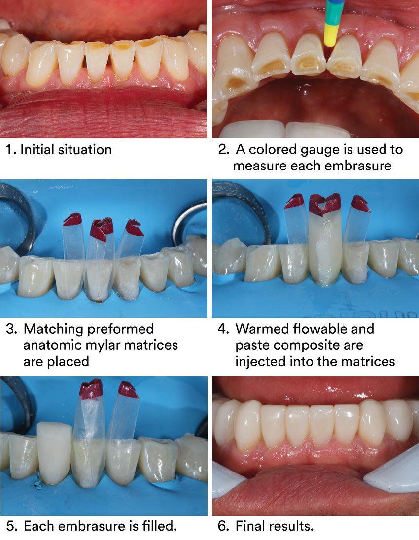 Informative oral care related imagery with a file name of Giuseppe-Chiodera-Fig.-5_rz.jpg shown on Solventum's "Brain Floss" blog