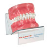 3M™ Typodont with Stand, 3M™ Clarity™ Advanced Ceramic Brackets,600-236, 1/Ea