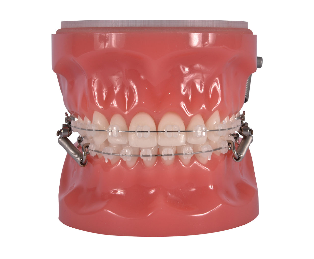 3M™ Forsus™ EZ2 with 3M™ Clarity™ Advanced Brackets, Consultation Model, 600-242