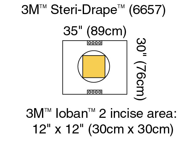 3M™ Steri-Drape™ Pouch with Ioban™ 2 Incise Film 6657, Incise area: 11"x 11" (30cm x 30cm), 10/Carton 4 Carton/Case