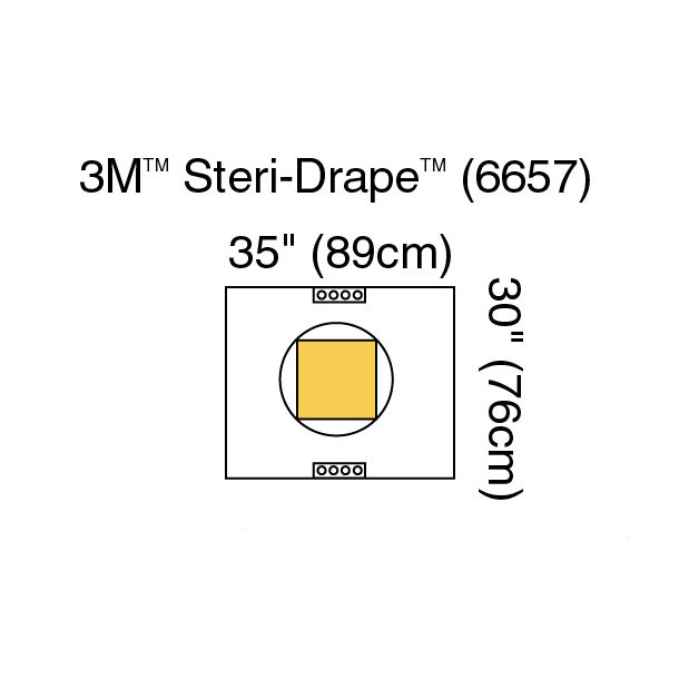 3M™ Steri-Drape™ Pouch with Ioban™ 2 Incise Film 6657, Incise area: 11"x 11" (30cm x 30cm), 10/Carton 4 Carton/Case