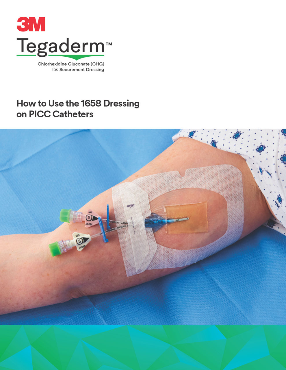 How to Use the 1658 Dressing on PICC Catheters