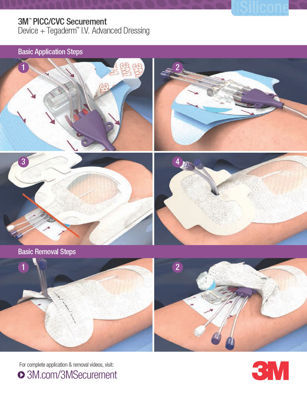 3M™ PICC/CVC Securement Device + Tegaderm™ I.V. Advanced Dressing 