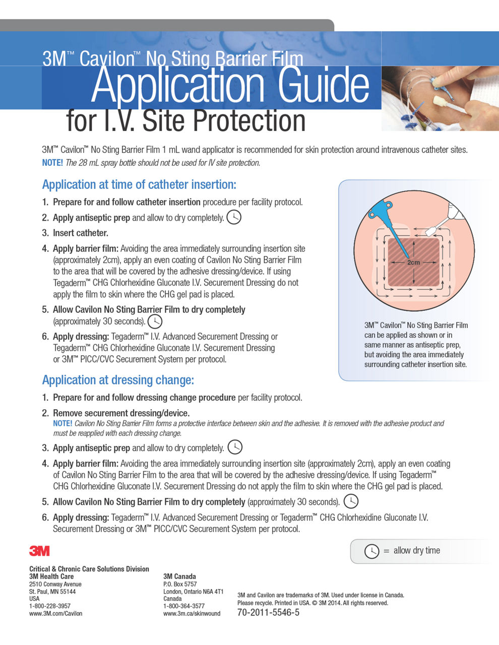 3M™ CaAvilonpp™ No Sting Barrier Flication Gilmuide