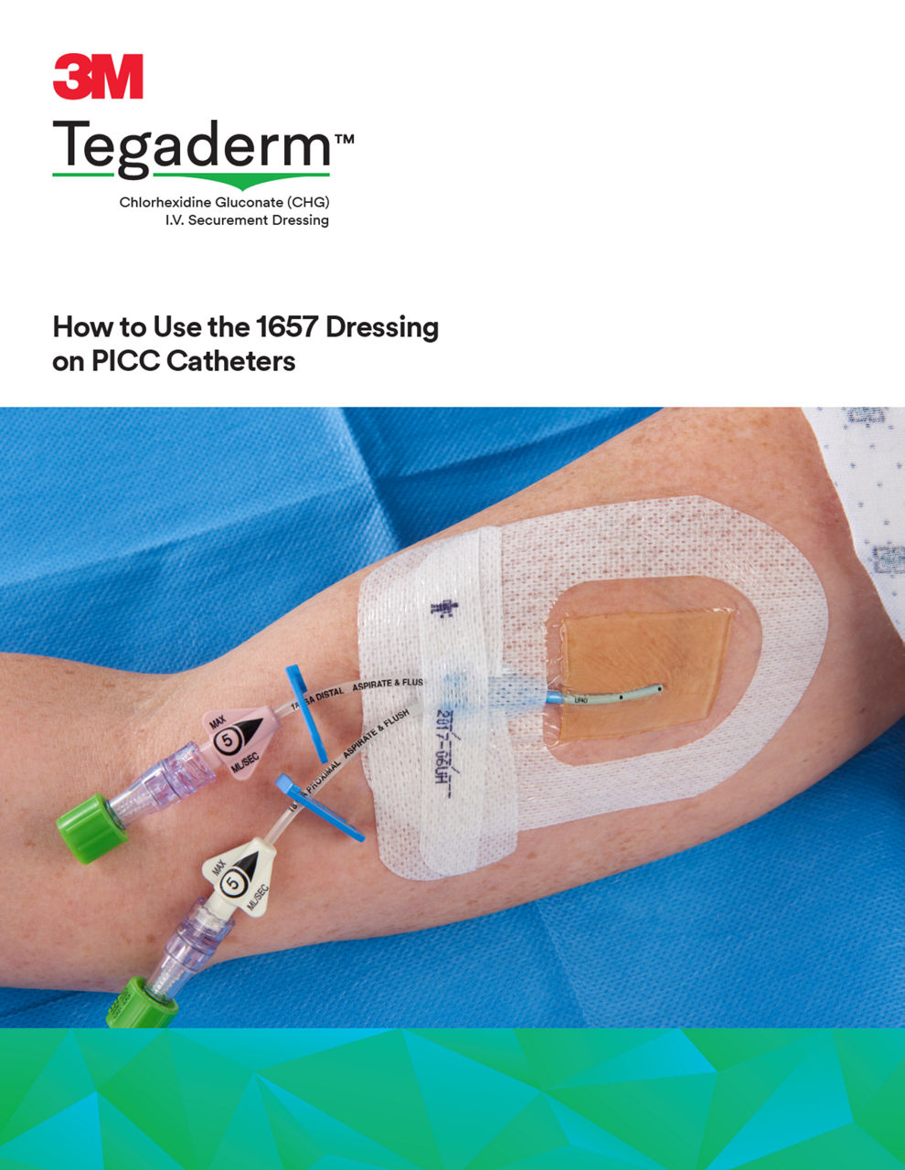 Tegaderm™ CHG (1657) - Application for PICC Guide