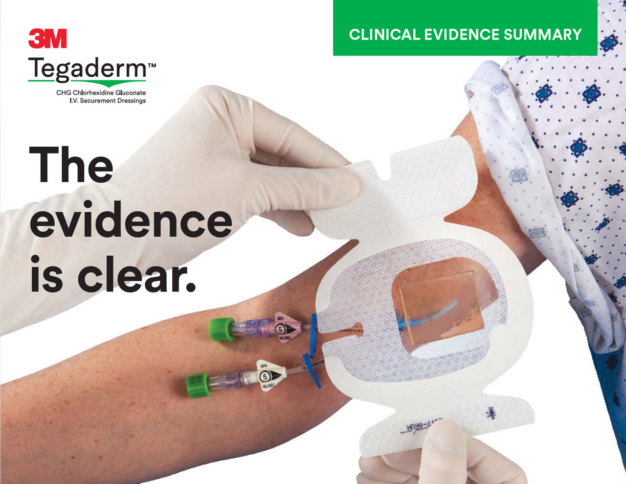 3M™ Tegaderm™ CHG Dressing Clinical Evidence Summary