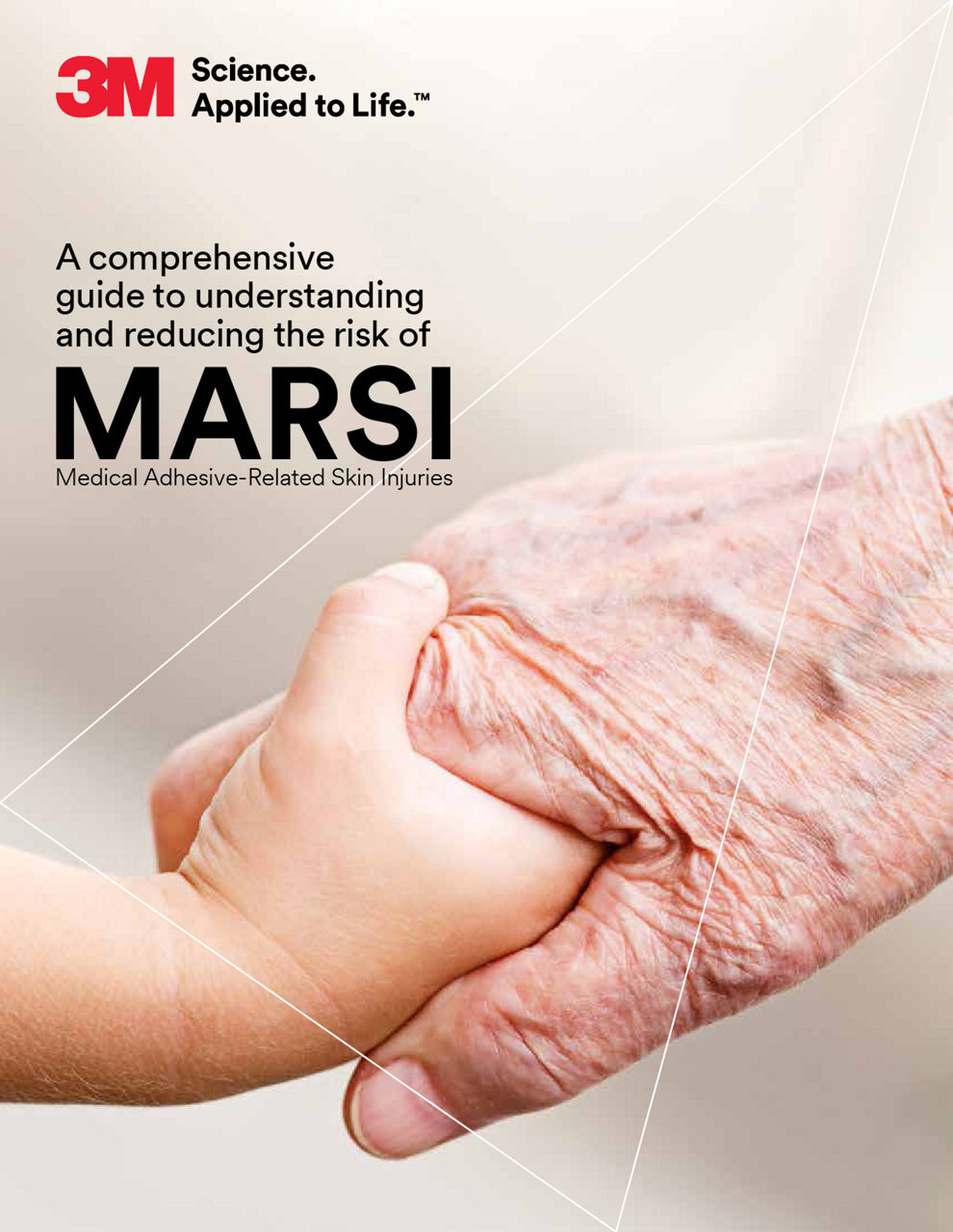 A comprehensive guide to understanding and reducing MARSI the risk of Medical Adhesive-Related Skin Injuries