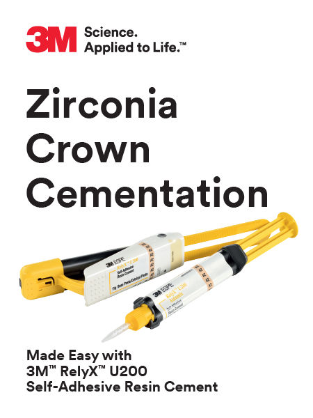 3M™ RelyX™ U200 and Ultimate Clicker Easy Use Guide for Zirconia and Glass Ceramic Crowns