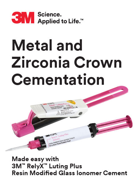 3M™ RelyX™ Luting Plus and Unicem 2 Easy Use Guide for Metal and Zirconia Crowns