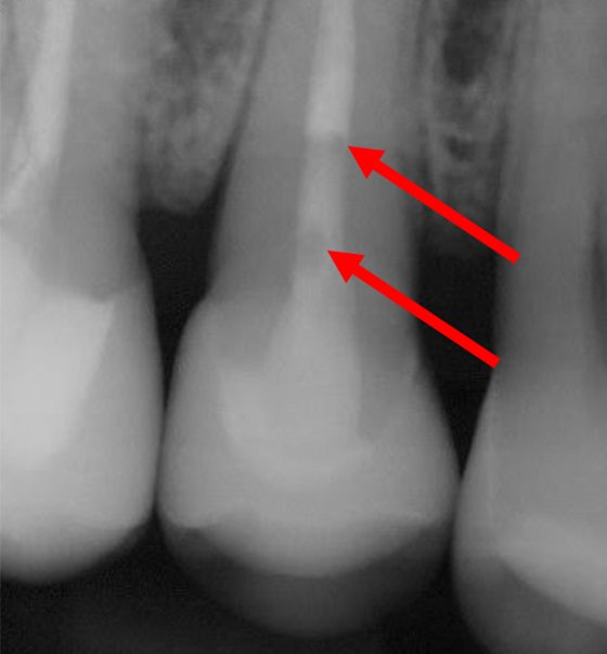 Informative oral care related imagery with a file name of Giuseppe-Chiodera-Fig.-7_rz.jpg shown on Solventum's "Brain Floss" blog