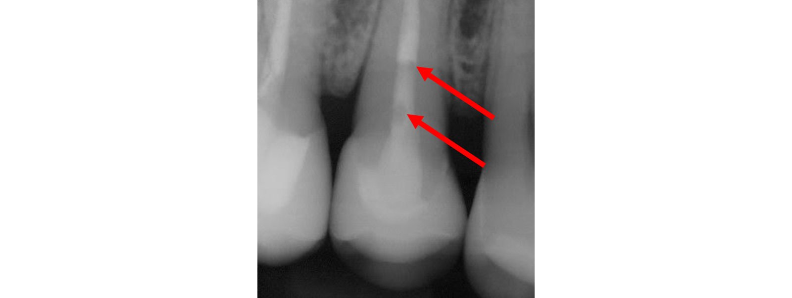 Informative oral care related imagery with a file name of Giuseppe-Chiodera-Fig.-7_rz.jpg shown on Solventum's "Brain Floss" blog
