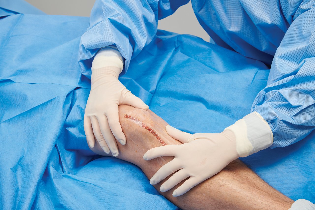 Step-by-step application of Tegaderm Absorbent Clear Acrylic Dressing on a knee incision. The dressing shown is 90815, but the application would be the same for 90817.